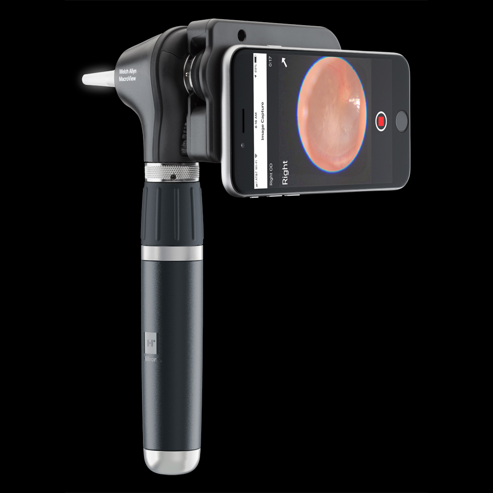 Welch Allyn MacroView Plus LED Otoscope Head 238-3